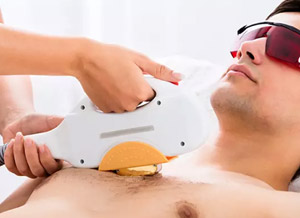 Full Chest Laser Hair Removal